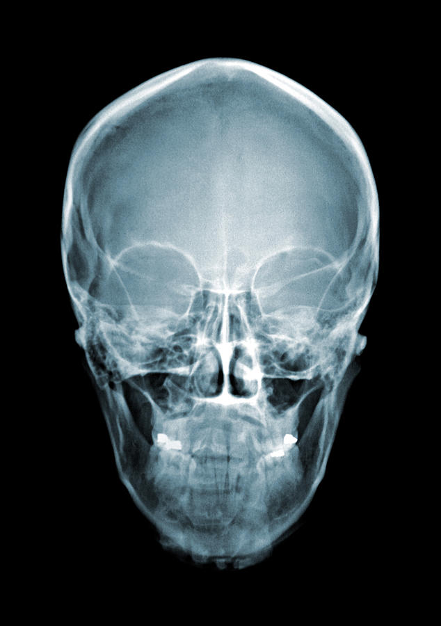 Skull Xray Photograph by Belterz
