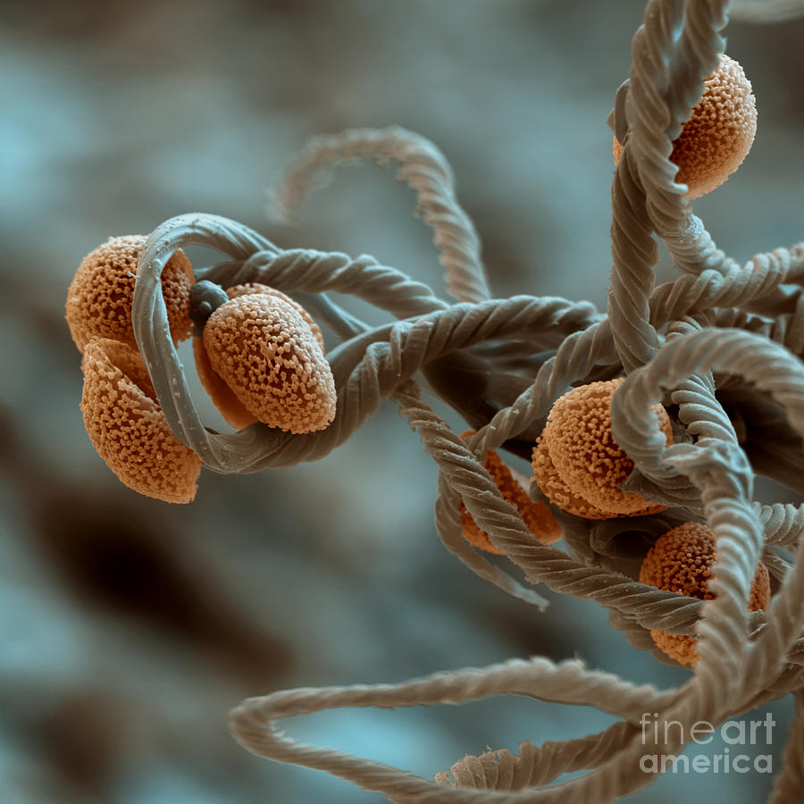 Slime Mold Spores Photograph by Eye of Science