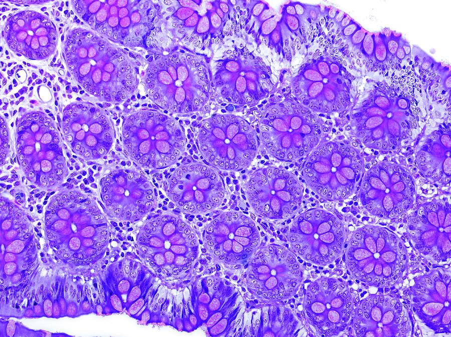 Small Intestine Tissue Photograph by Microscape