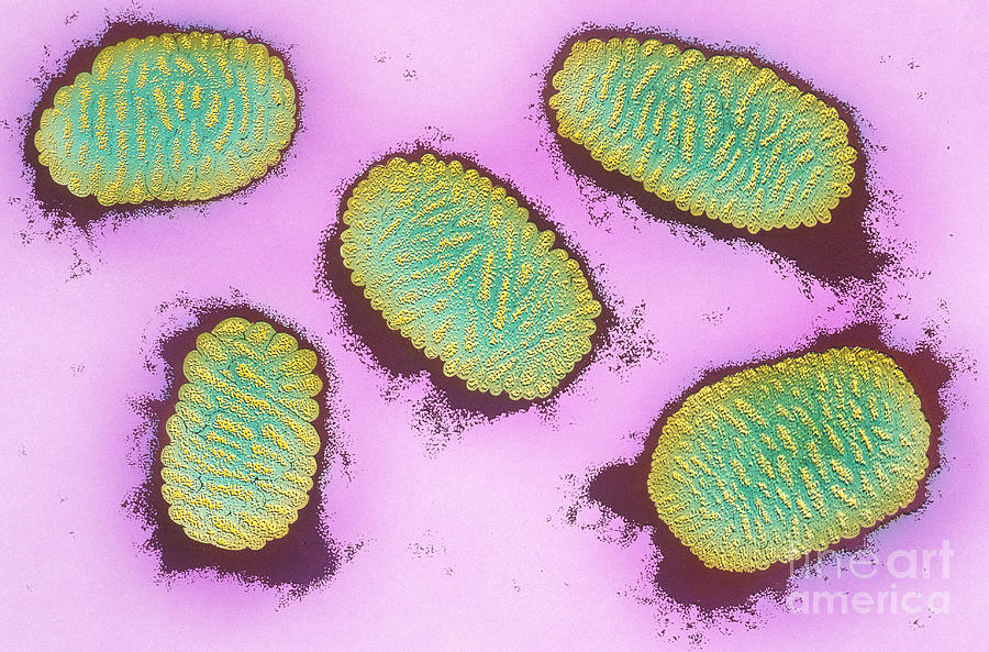 Smallpox Virus Photograph by Chris Bjornberg