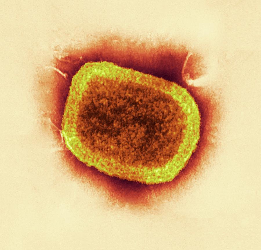 cdc-smallpox-virus-samples-found-in-lab-are-live-huffpost