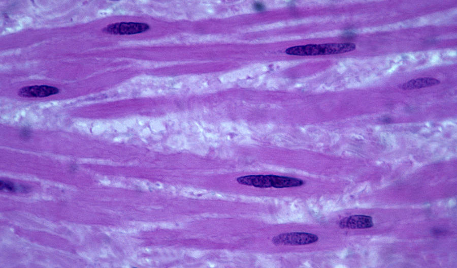SMOOTH MUSCLE FIBERS (or CELLS) in a blood vessel wall, 250X Photograph by Ed Reschke