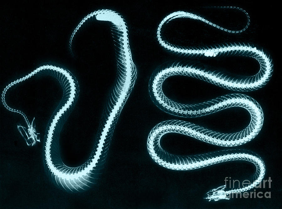 Snake Skeletons X-ray Photograph by Science Source