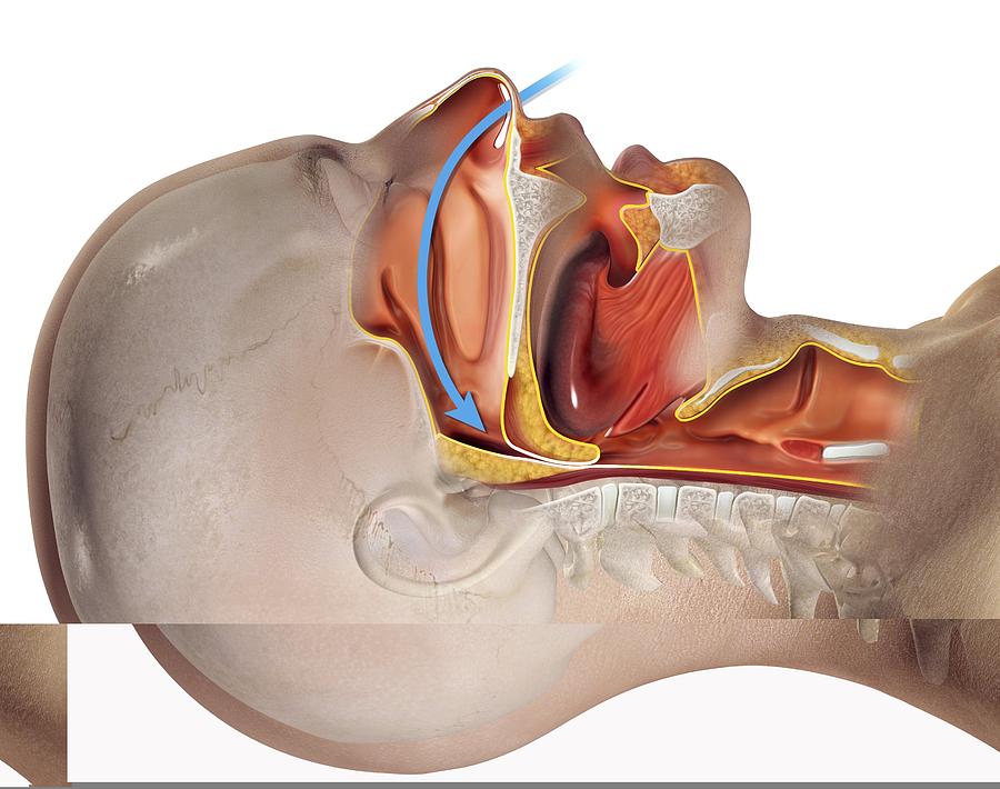Anatomical Photograph - Snoring, artwork by Science Photo Library