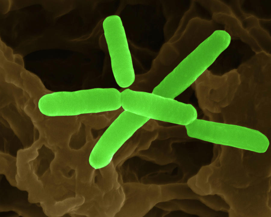 Soil Bacterium (bradyrhizobium Sp.) Photograph by Dennis Kunkel Microscopy/science Photo Library