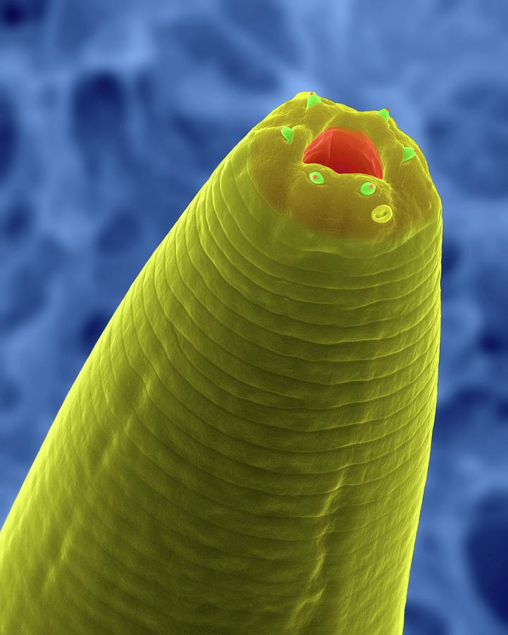 Soil Nematode (caenorhabditis Elegans) Photograph by Dennis Kunkel ...