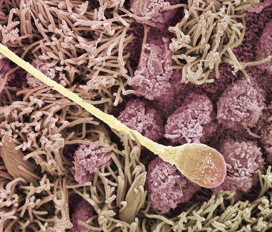 Sperm cell. Scanning electron microscope (SEM) Photograph by Science Photo Library - STEVE GSCHMEISSNER.