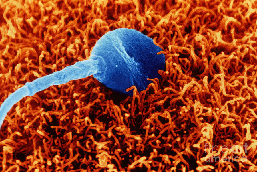 Sperm Embedded In Egg Photograph by David M. Phillips