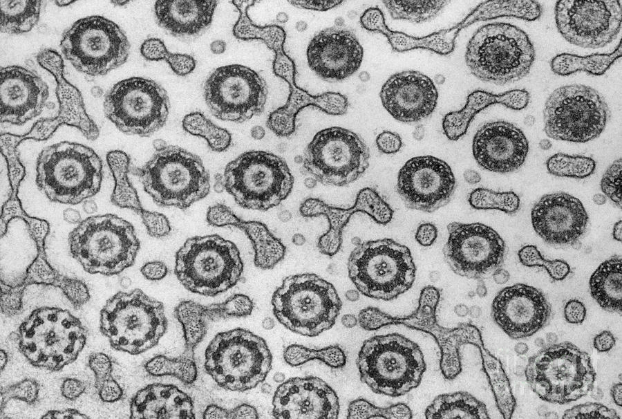 Sperm Flagella, Tem Photograph by Biology Pics