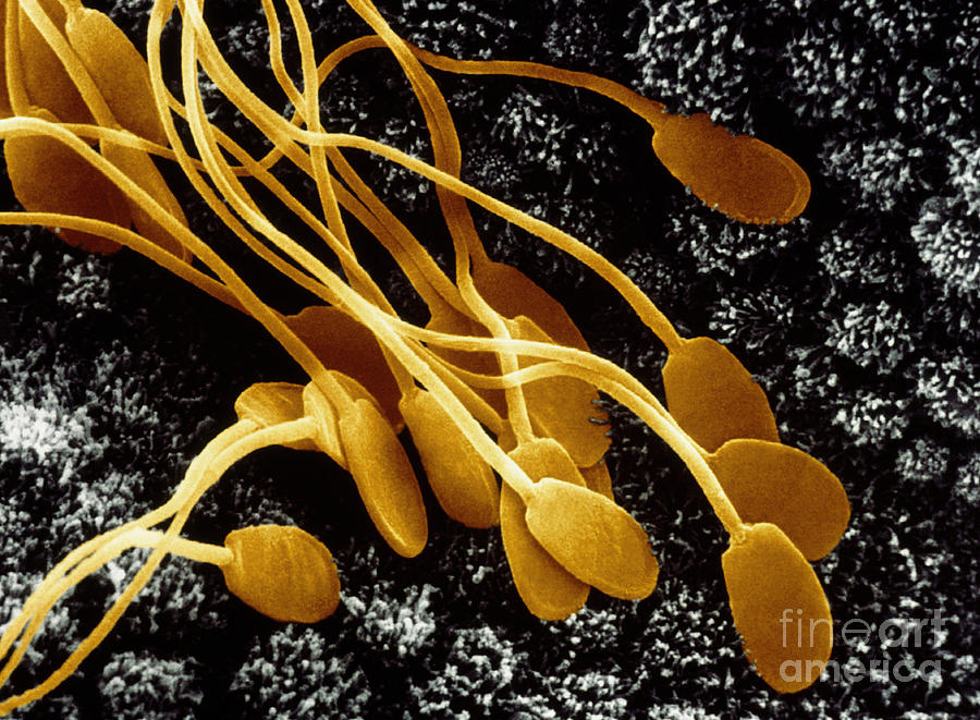 Sperm In Uterus Photograph by David M. Phillips