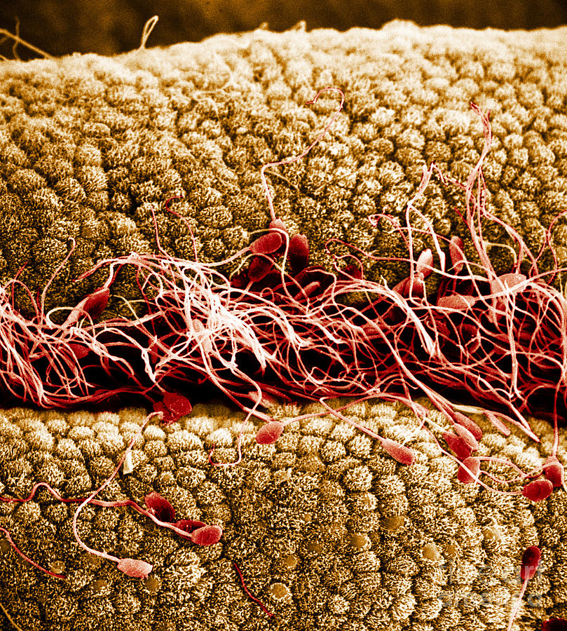 Sperm On Oviduct Surface, Sem Photograph by David M. Phillips