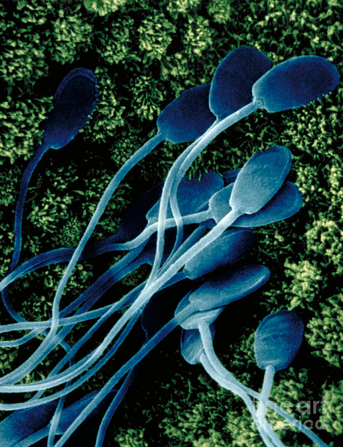 Sperm On The Uterine Wall Photograph by David M. Phillips