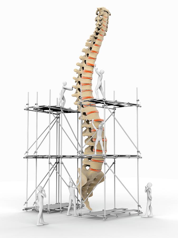 Spine With Workers Photograph by Alfred Pasieka/science Photo Library
