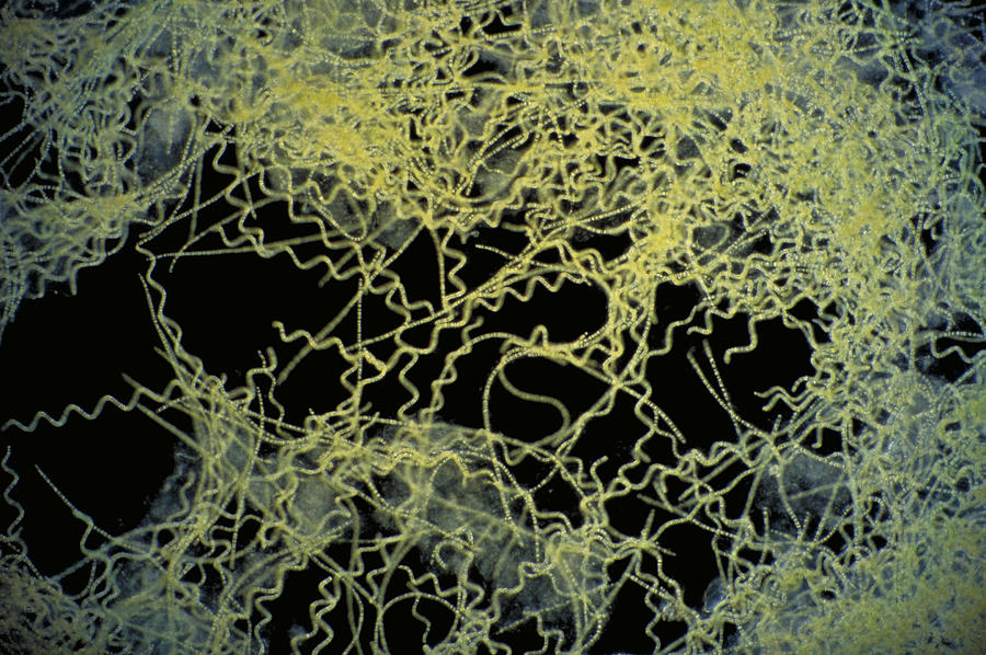 Spirulina Platensis Algae Photograph by Michael Abbey