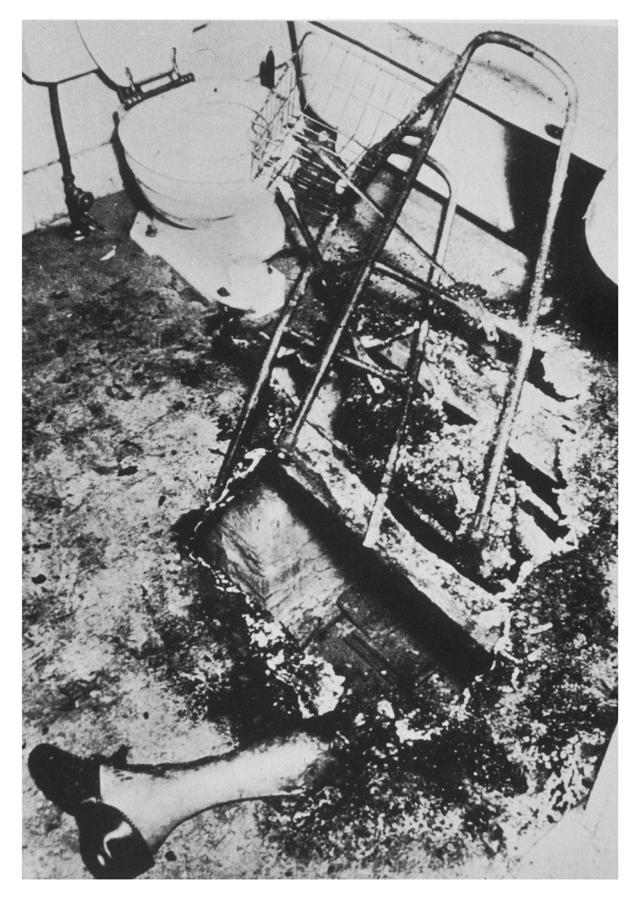 'spontaneous Combustion' The Remains Photograph by Mary Evans Picture ...