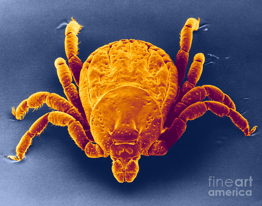 Spotted Fever Tick, Sem Photograph by David M. Phillips