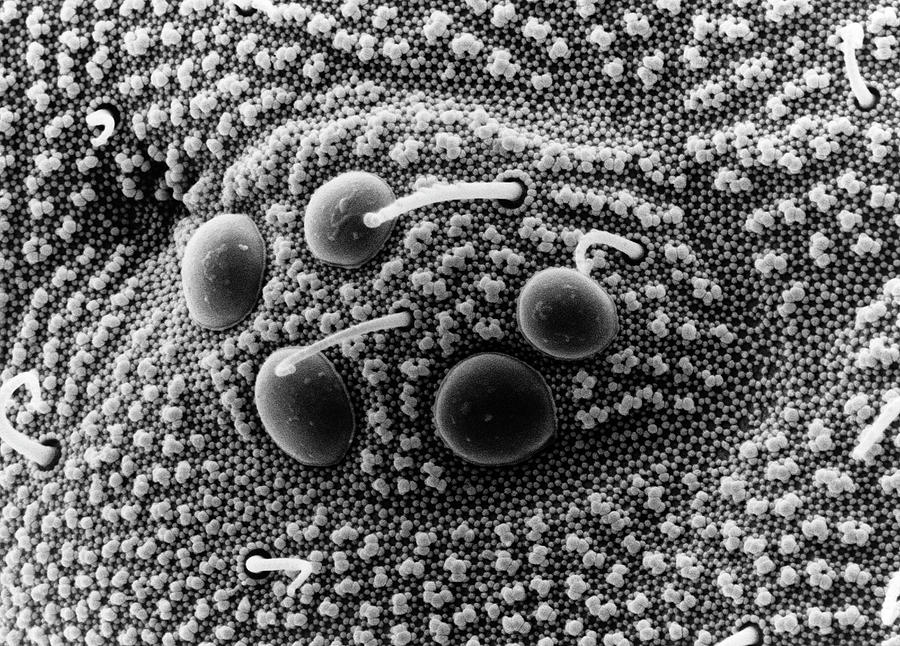Springtail Eye Photograph by Dr Jeremy Burgess/science Photo Library