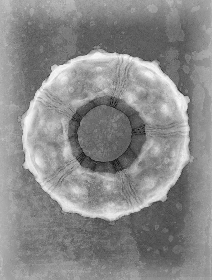 Sputnik Sea Urchin X-ray Art Photograph by Roy Livingston