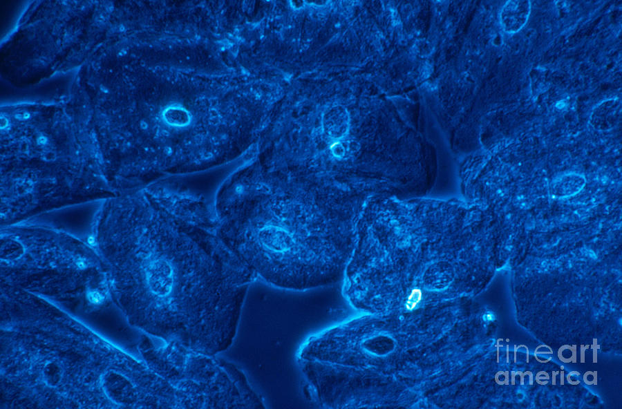 Squamous Epithelial Cells, Lm Photograph by David M. Phillips