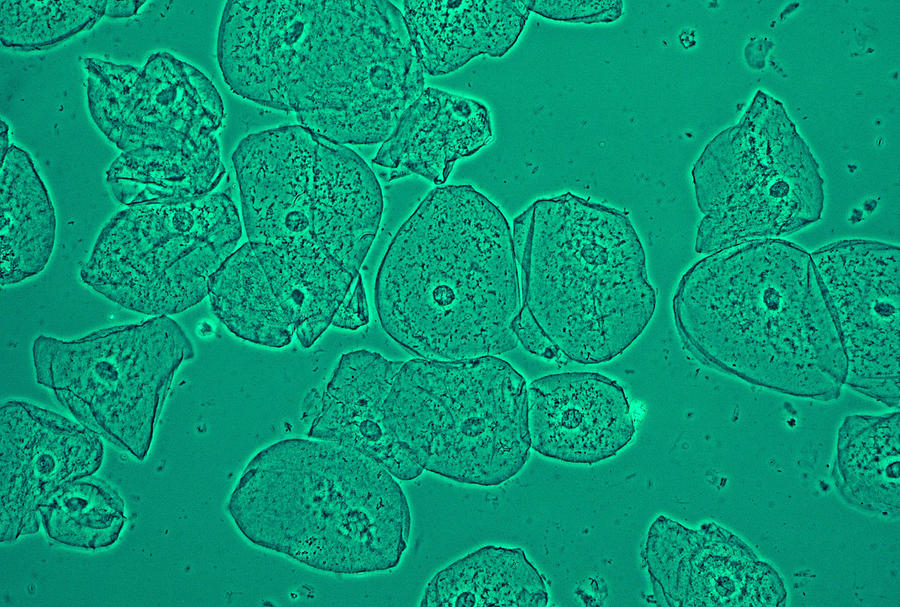 Squamous Epithelial Cells, Lm Photograph by Joaquin Carrillo-Farga