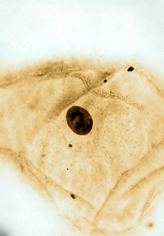 Squamous Epithelium Nucleus, Lm Photograph by Omikron