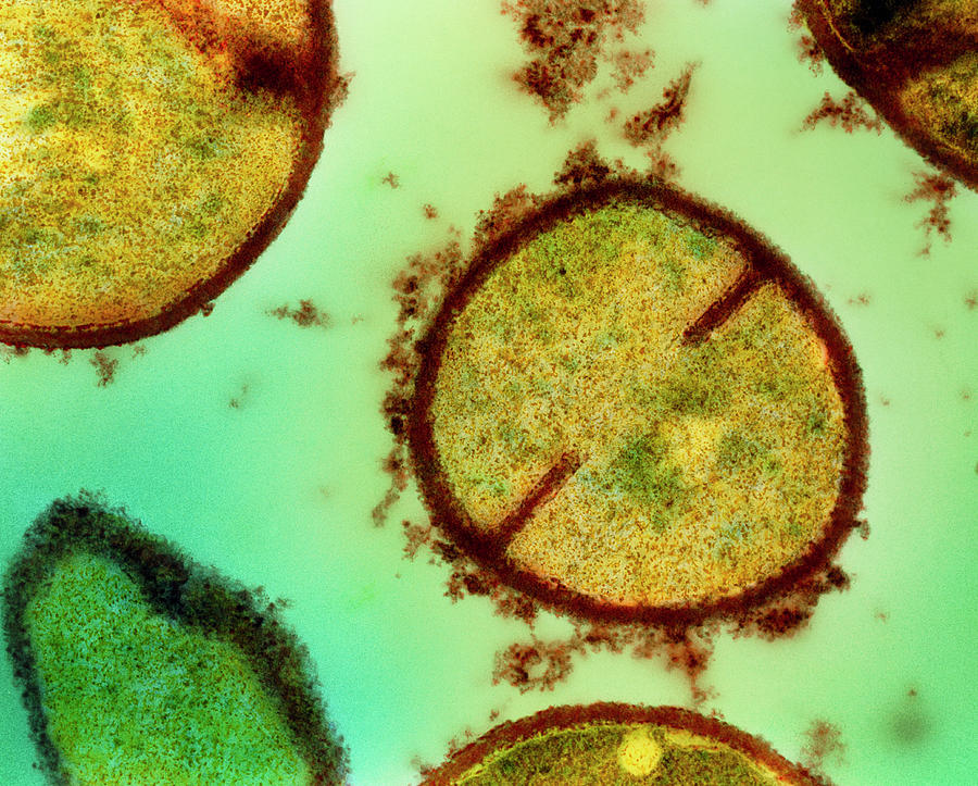 Staphylococcus Aureus Bacteria Photograph by Dr Kari Lounatmaa/science Photo Library
