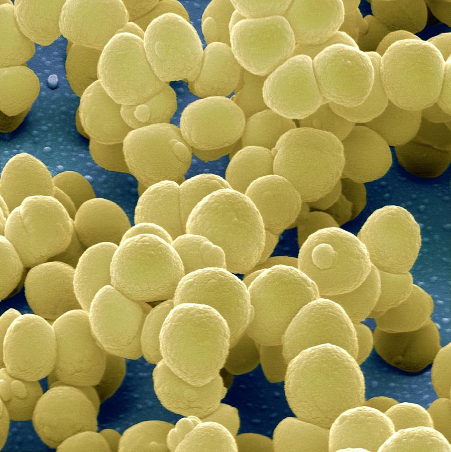 Staphylococcus aureus bacteria - Stock Image - B234/0142 - Science Photo  Library