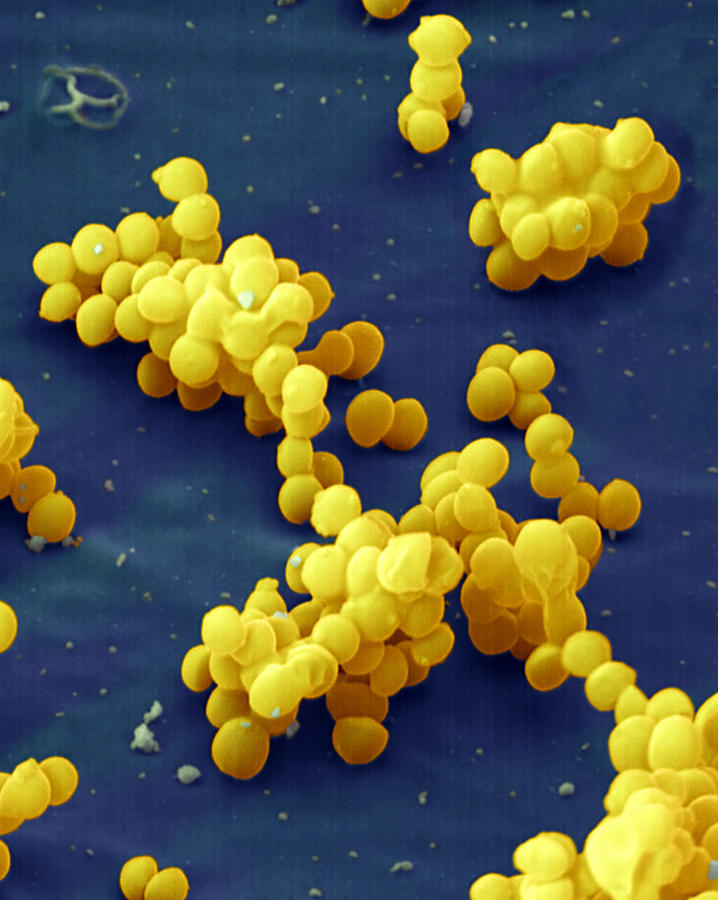 Staphylococcus Aureus Photograph by Eye of Science