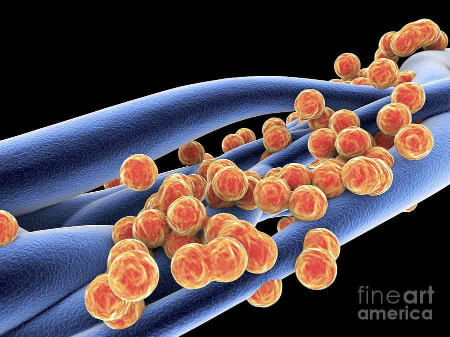 Antibiotic Resistant Photograph - Staphylococcus aureus MRSA bacteria by Spl