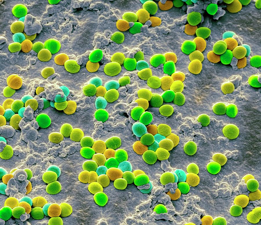 Staphylococcus Bacteria Photograph by Steve Gschmeissner/science Photo Library