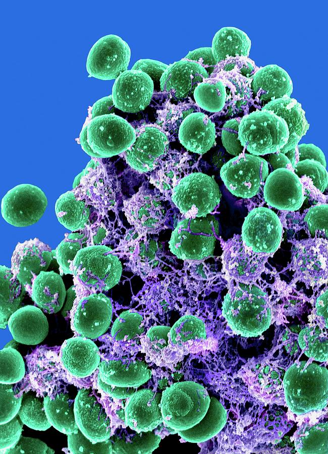 Staphylococcus Epidermidis Bacteria Photograph by Dr Michael Otto, Niaid/national Institutes Of Health/science Photo Library