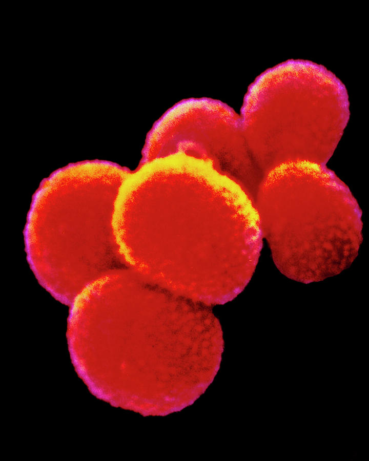 Staphylococcus Sp. Bacteria Photograph by Cnri/science Photo Library