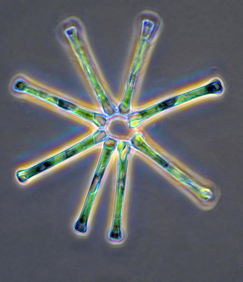 Stellate Diatom Photograph by Sinclair Stammers/science Photo Library