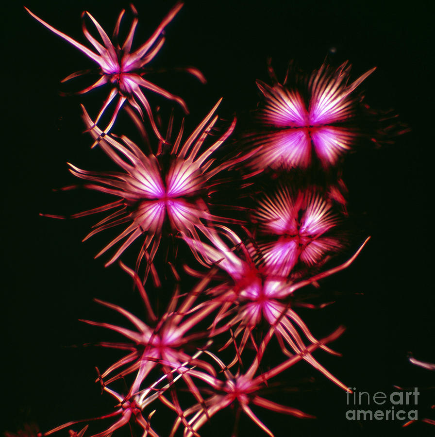 Elaeagnus Pungens Photograph - Stellate Hairs Of Thorny Olive by De Agostini Picture Library