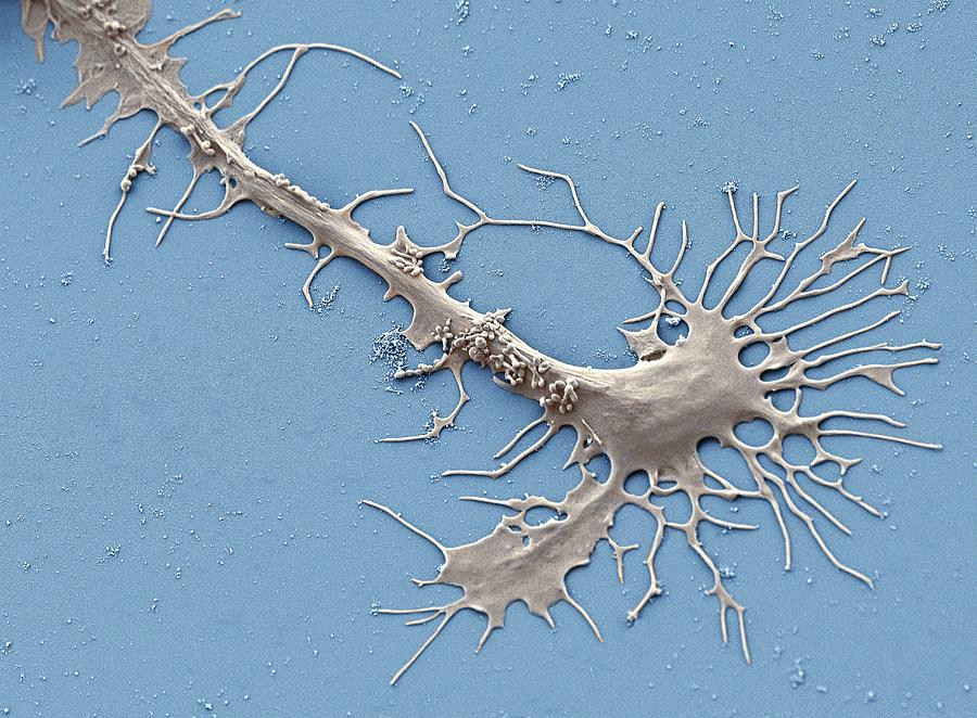 Stem Cell-derived Neuron Growth Cone Photograph by Thomas Deerinck, Ncmir/science Photo Library