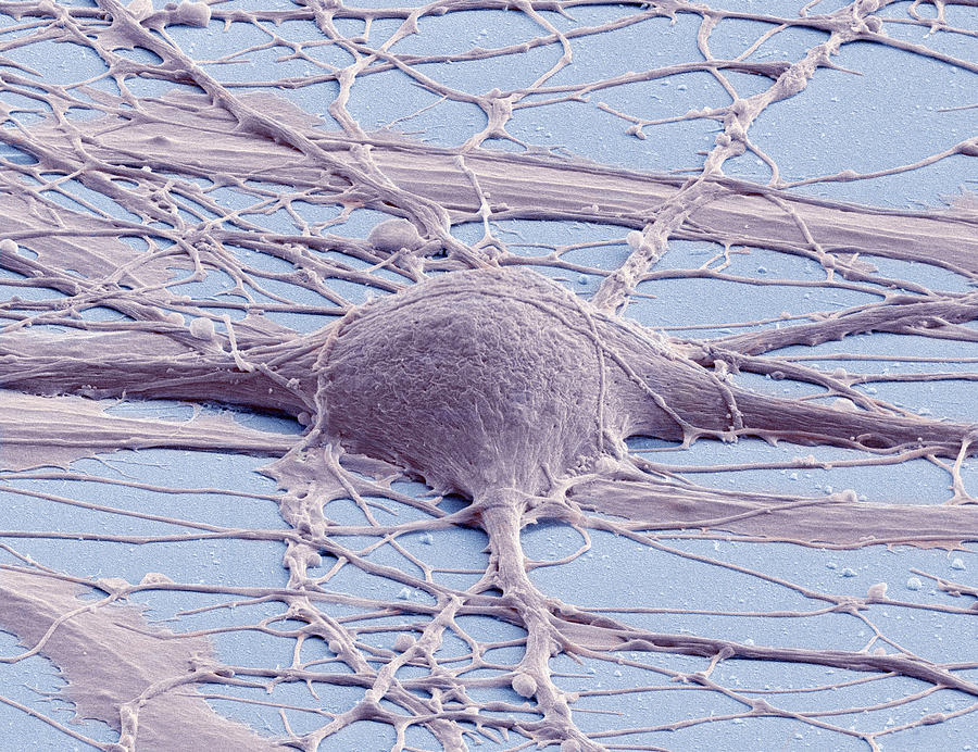 Stem Cell-derived Neuron Photograph by Thomas Deerinck, Ncmir