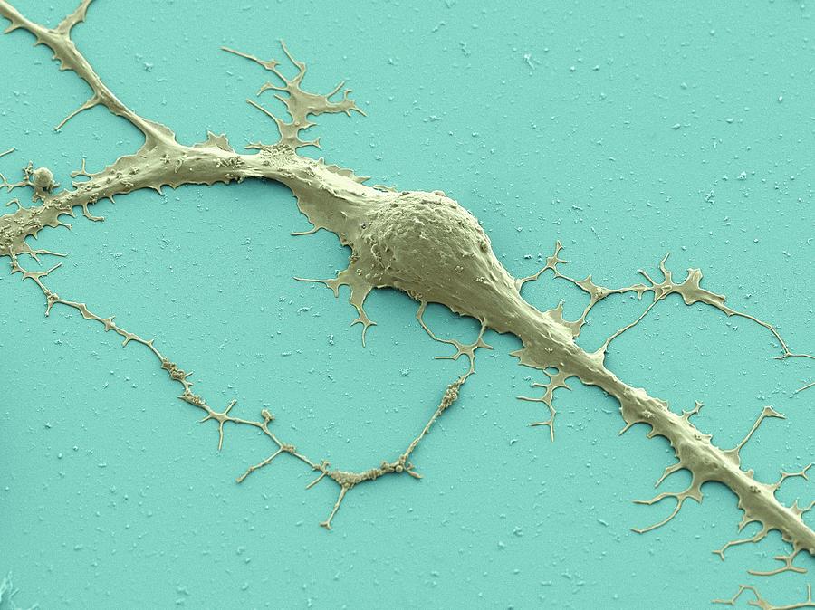 Stem Cell-derived Neuron Photograph by Thomas Deerinck, Ncmir/science Photo Library
