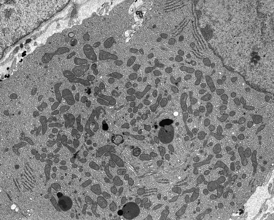 Steroid Secreting Cell Tem By Science Photo Library