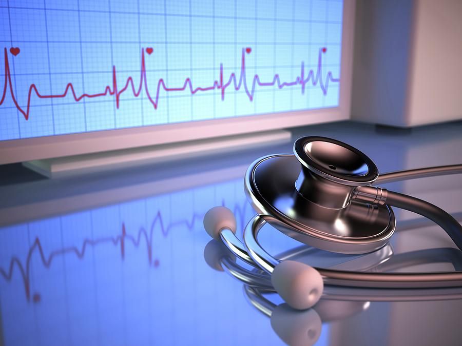 cardiograph is cardiograph is