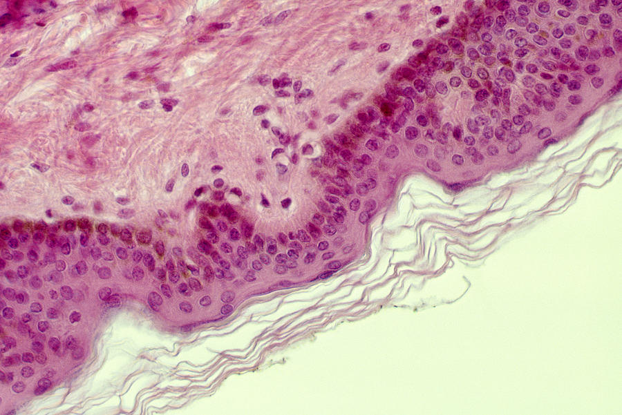 Stratified Squamous Cells