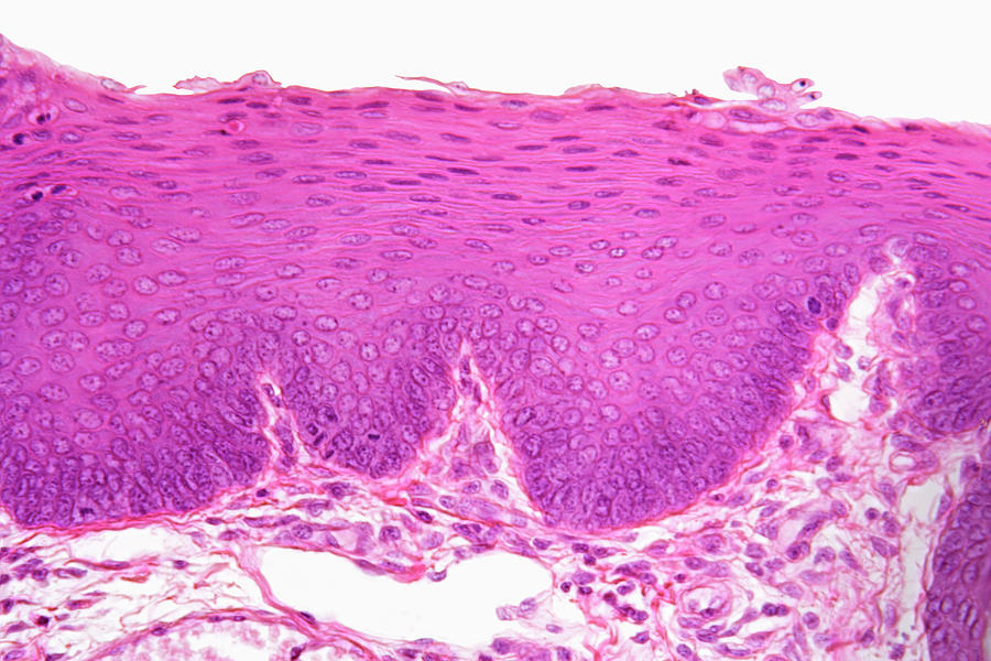 Stratified Squamous Epithelium Tissue | Images and Photos finder