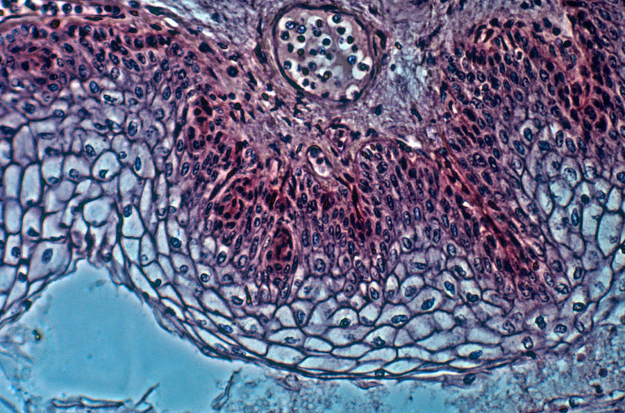 Stratified Squamous Epithelium Photograph By Robert Knauft Biology Pics Pixels