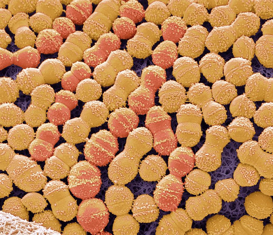 Streptococcus Mutans Photograph by Steve Gschmeissner/science Photo Library