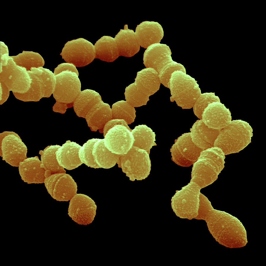 streptococcus pneumoniae under microscope