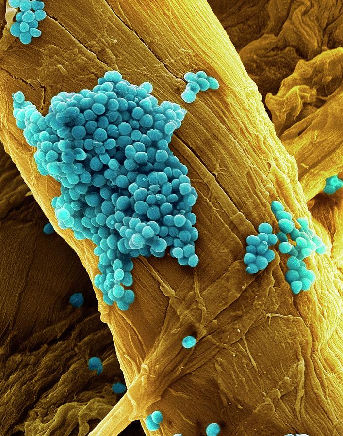 Streptococcus Pneumoniae Bacteria Photograph by Steve Gschmeissner