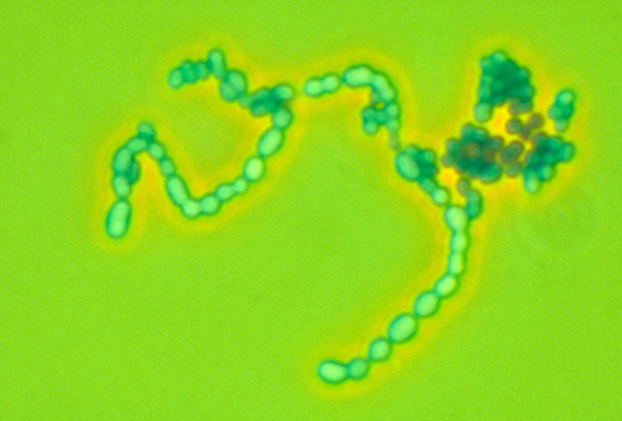 Streptococcus Pyogenes Photograph by Michael Abbey