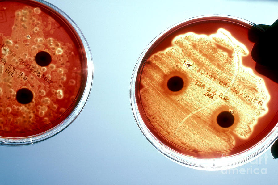 Streptococcus Pyogenes Photograph by Van D. Bucher