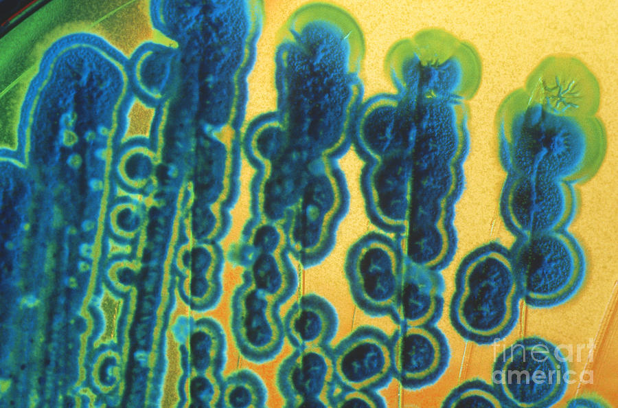 Streptomyces Photograph by Charlotte Raymond