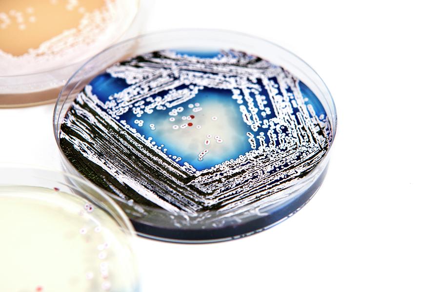 Streptomyces Coelicolor Photograph - Streptomyces Coelicolor Bacterial Culture by Lewis Houghton/science Photo Library Streptomyces Coelicolor Photograph - Streptomyces Coelicolor Bacterial Culture by Lewis Houghton/science Photo Library