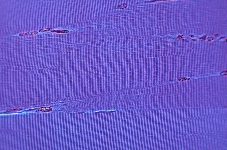 Striated Muscle, Lm Photograph by Joseph F. Gennaro Jr.
